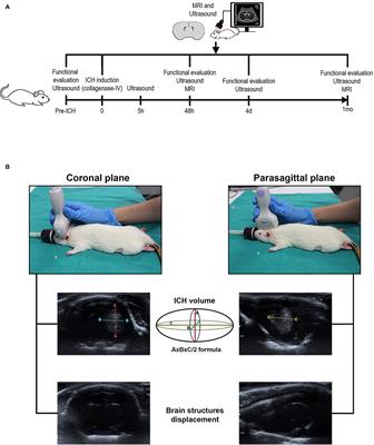 B-Mode Ultrasound, a Reliable Tool for Monitoring Experimental Intracerebral Hemorrhage